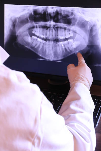 Best Emergency Treatment for Toothache in Stone Ridge, NY